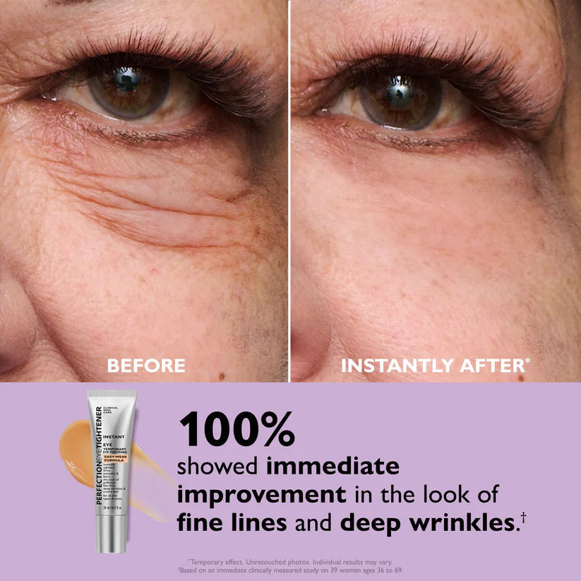 🌸 Youthful Perfection™ Eye Primer & Tightener ✨
