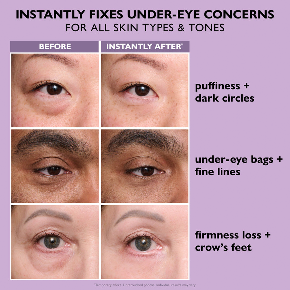 🌸 Youthful Perfection™ Eye Primer & Tightener ✨